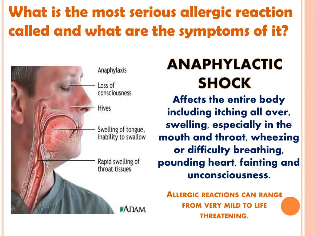 what is the most serious allergic reaction called