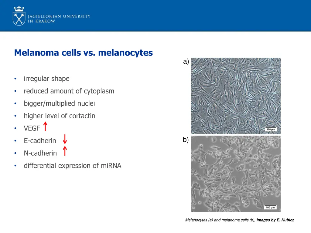 melanoma cells vs melanocytes