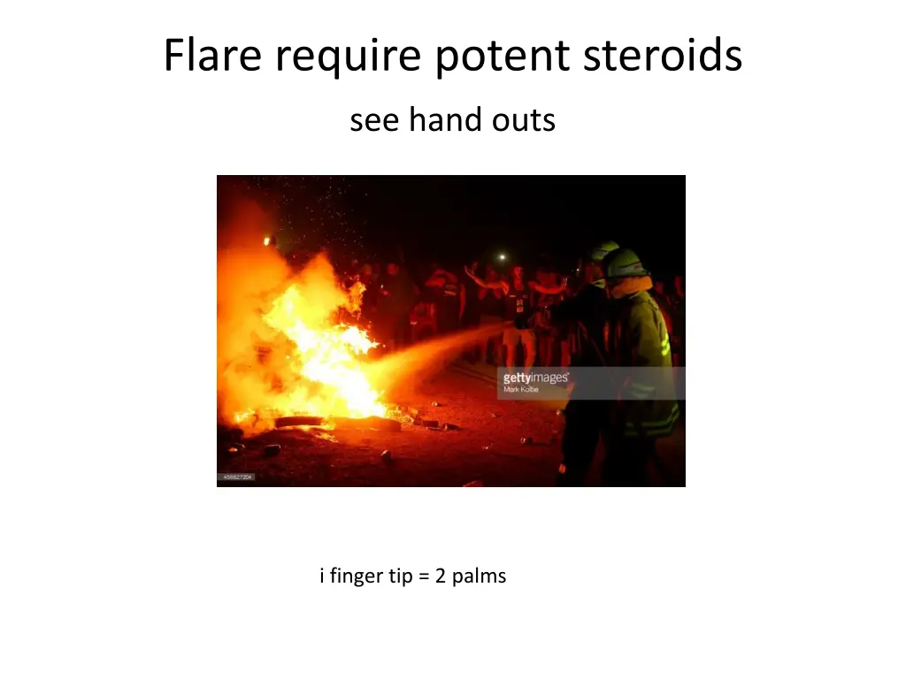 flare require potent steroids