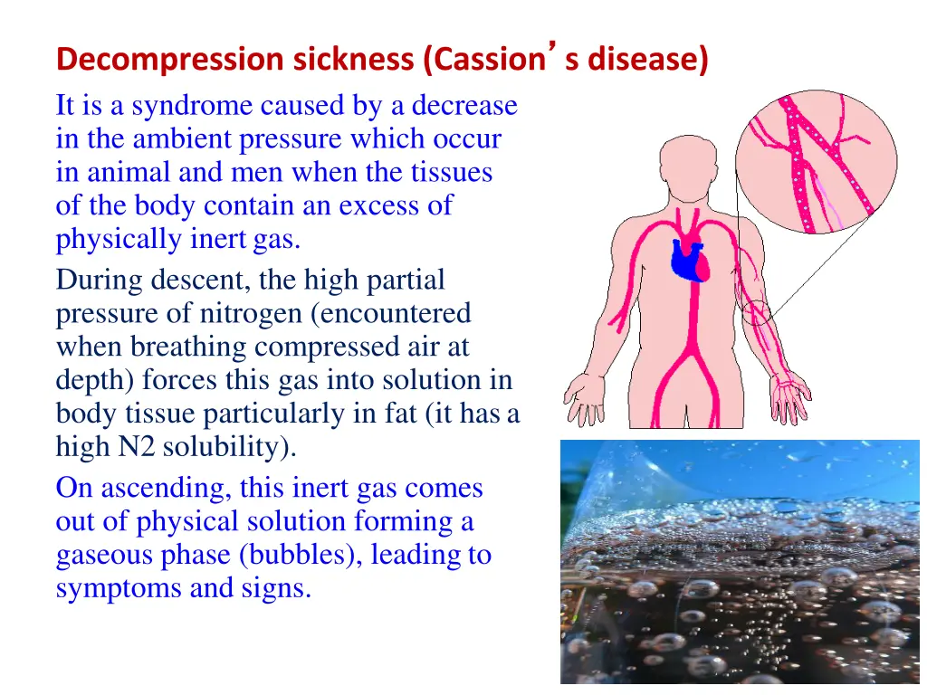 decompression sickness cassion s disease