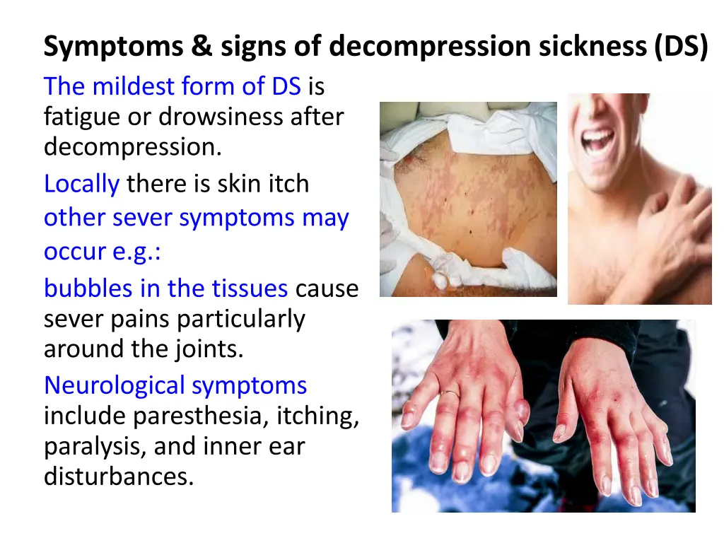 symptoms signs of decompression sickness