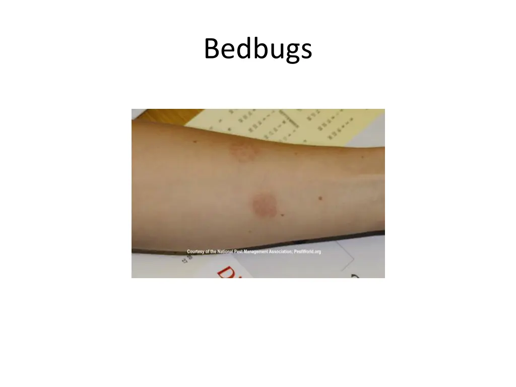 bedbugs