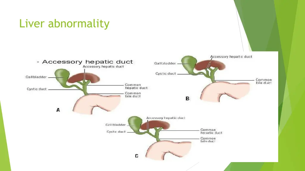 liver abnormality 1