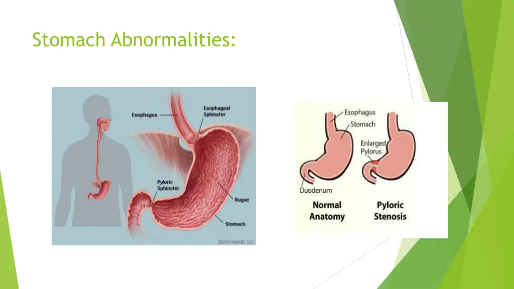 stomach abnormalities