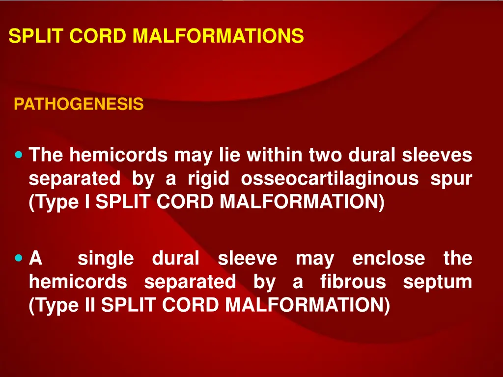 split cord malformations 4