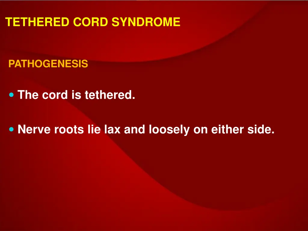 tethered cord syndrome 2