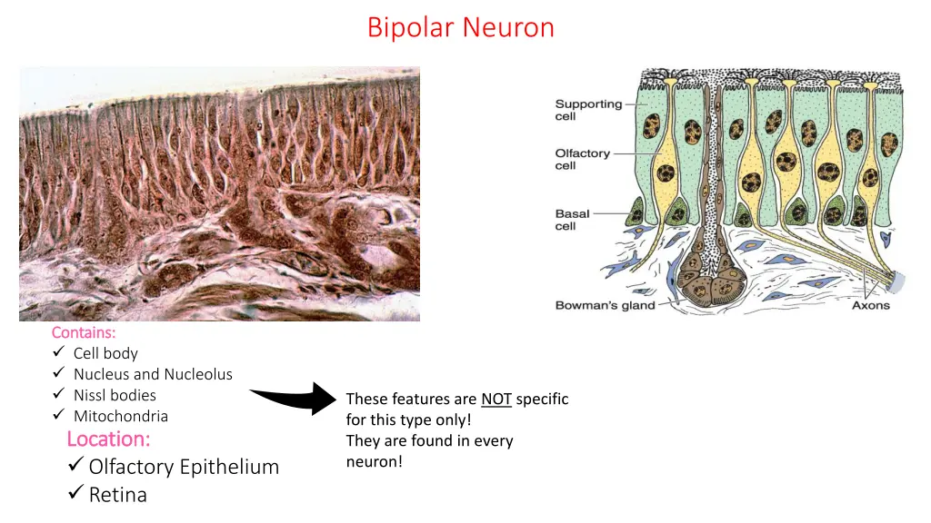 bipolar neuron