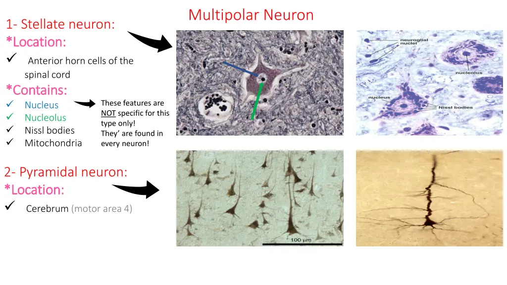 multipolar neuron