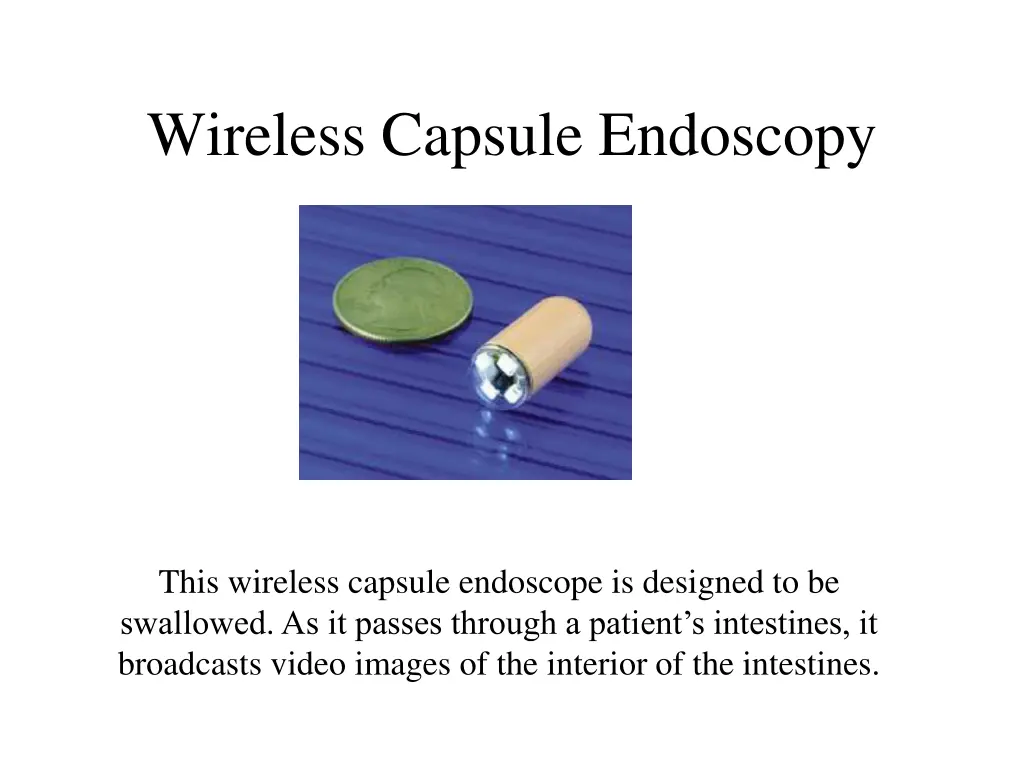 wireless capsule endoscopy