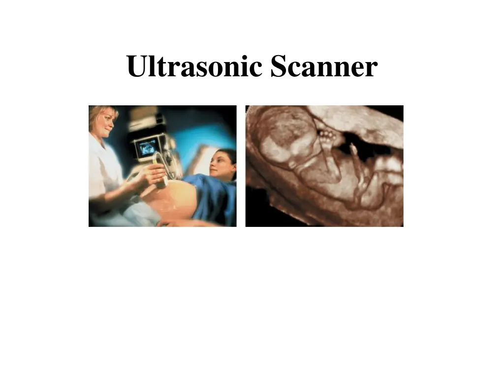 ultrasonic scanner