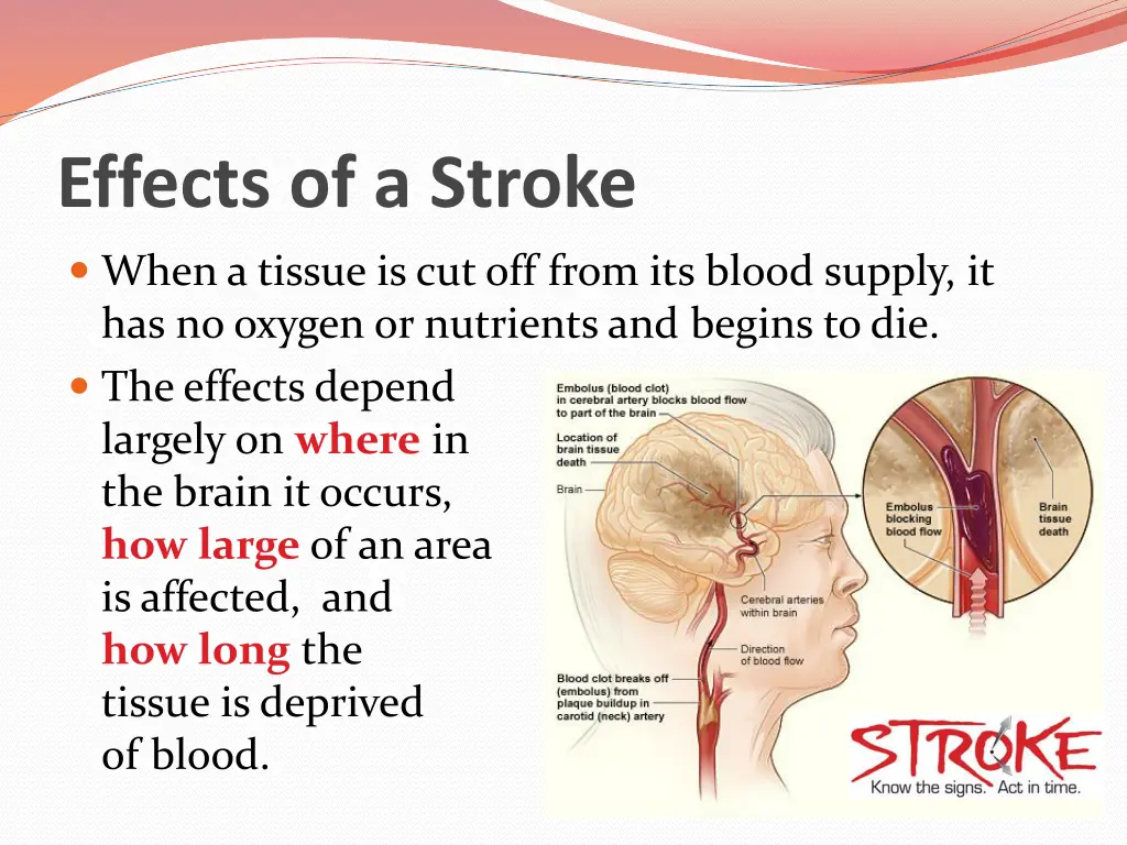 effects of a stroke