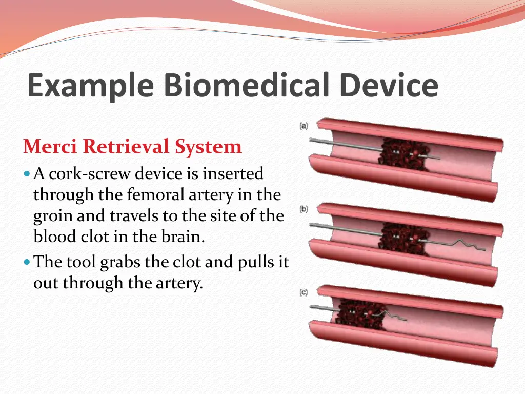 example biomedical device