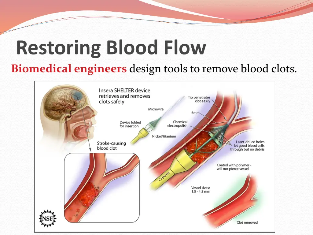 restoring blood flow biomedical engineers design