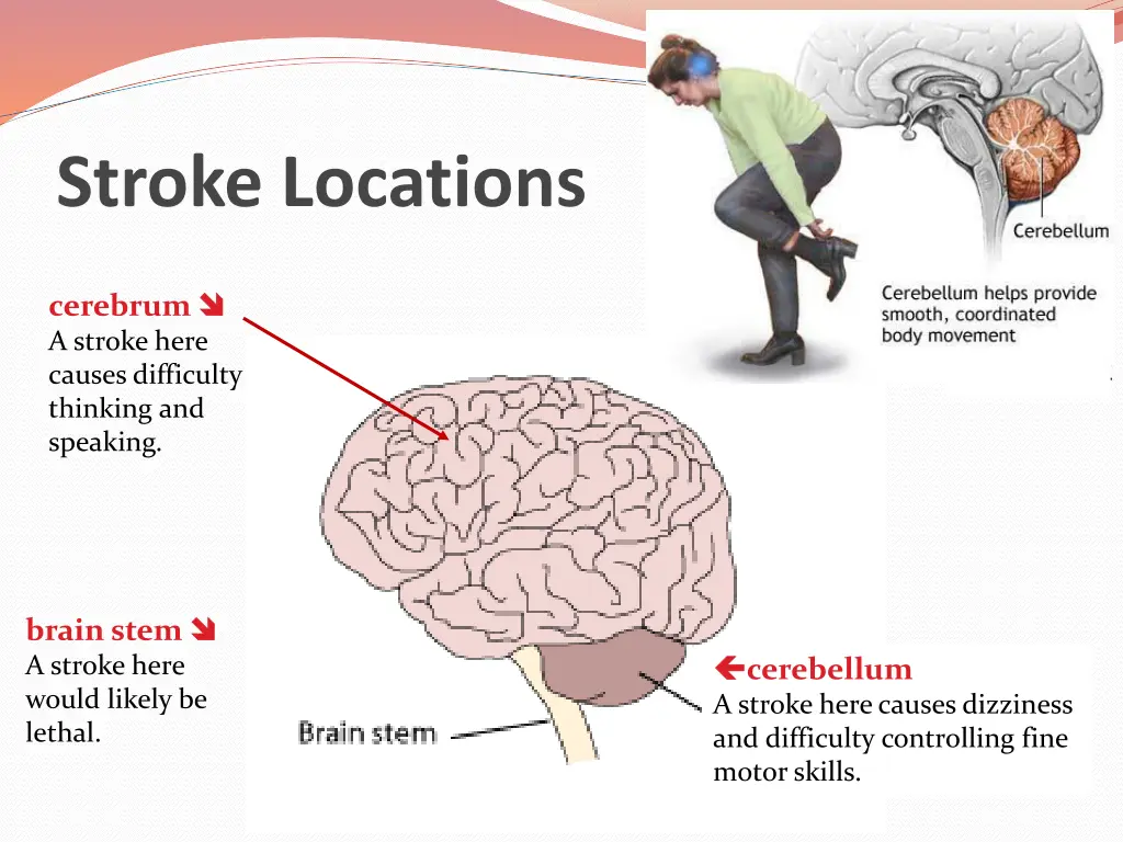 stroke locations