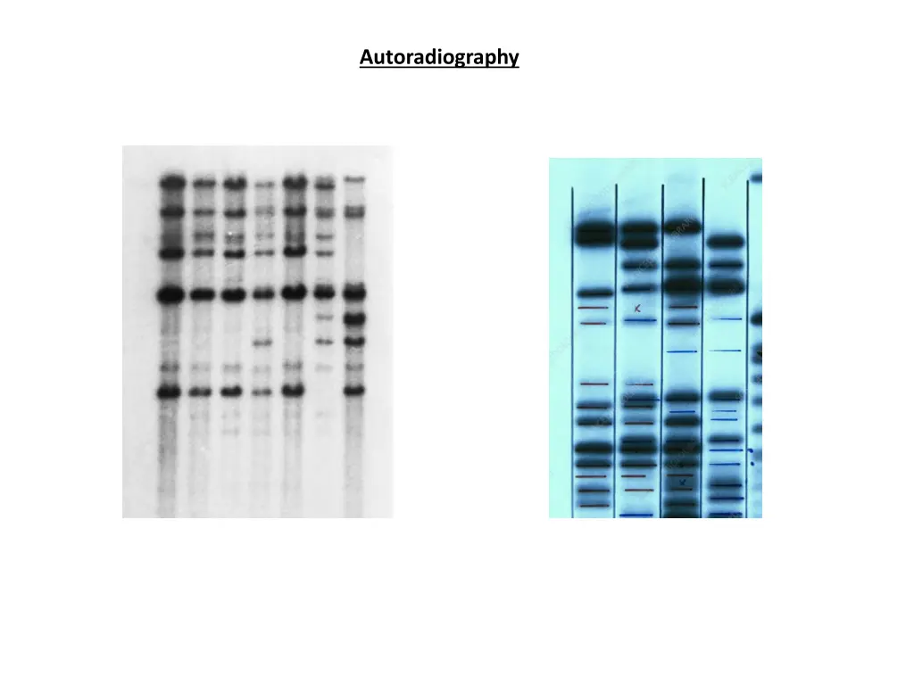 autoradiography