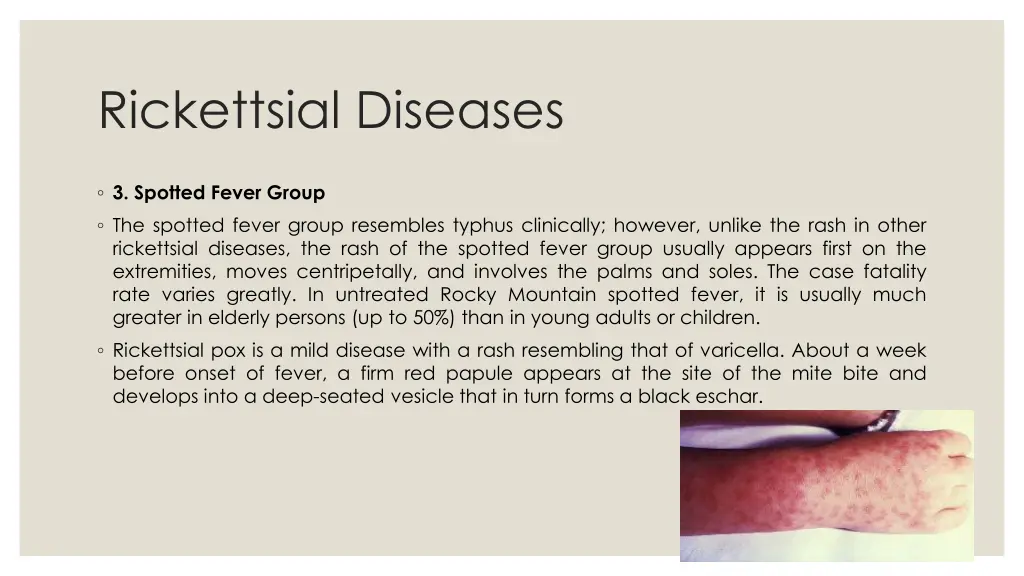 rickettsial diseases 1