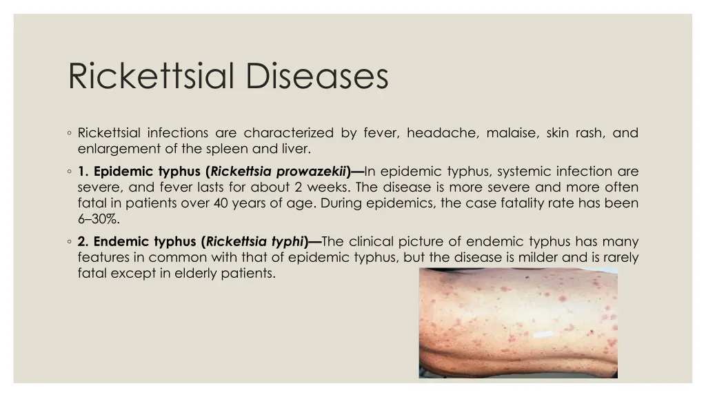 rickettsial diseases