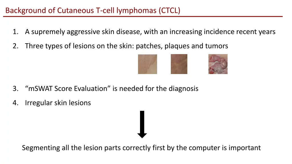 background of cutaneous t cell lymphomas ctcl