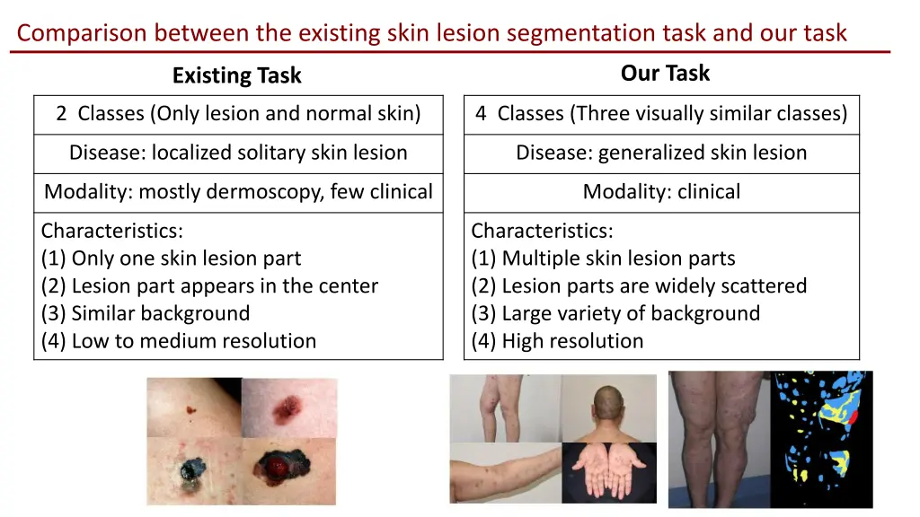 comparison between the existing skin lesion