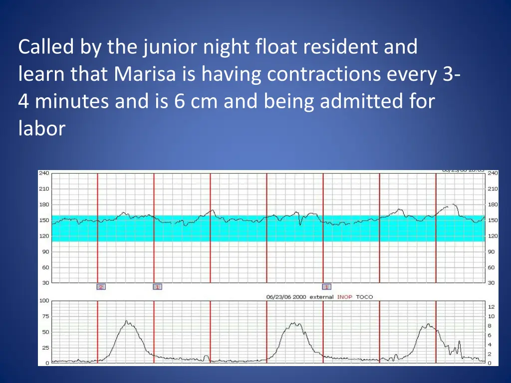 called by the junior night float resident