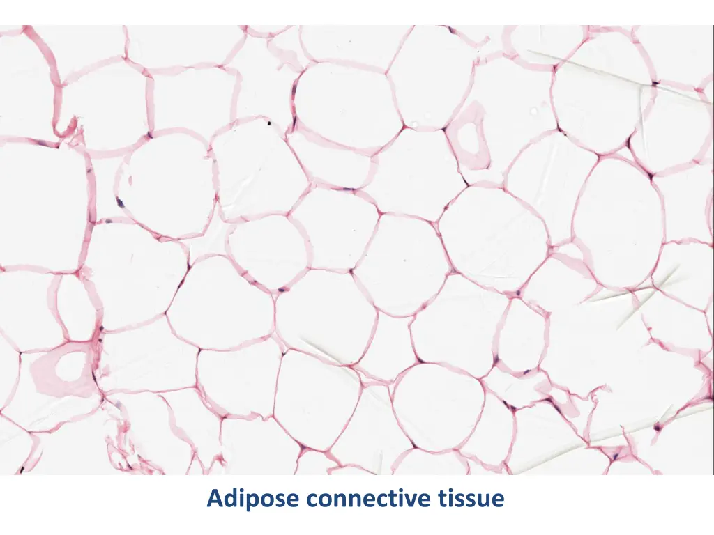 adipose connective tissue 1