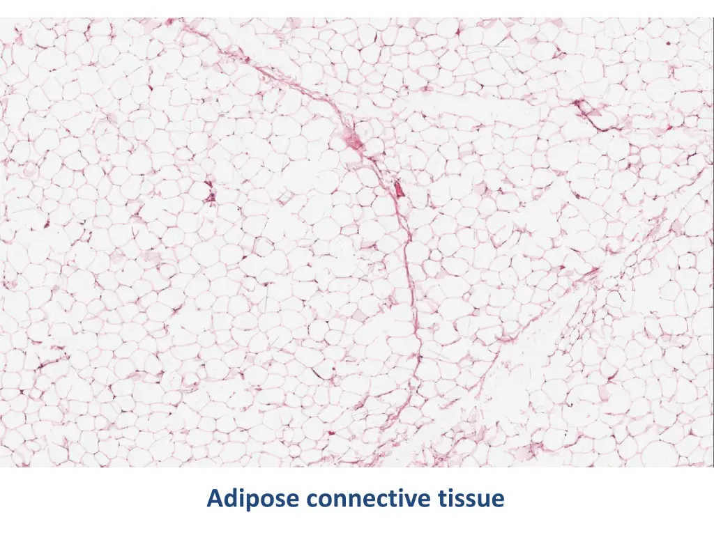 adipose connective tissue