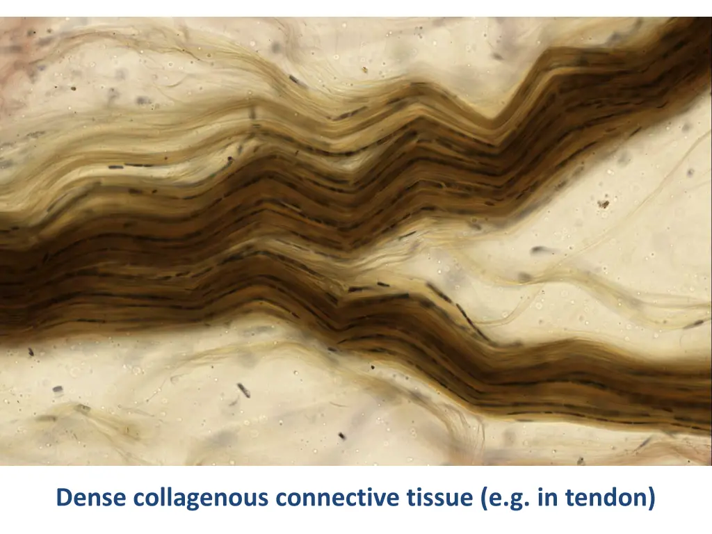 dense collagenous connective tissue e g in tendon 1