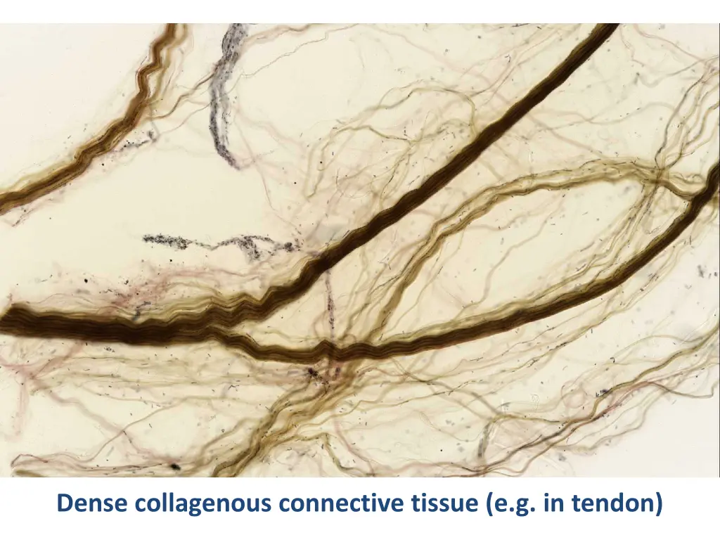 dense collagenous connective tissue e g in tendon