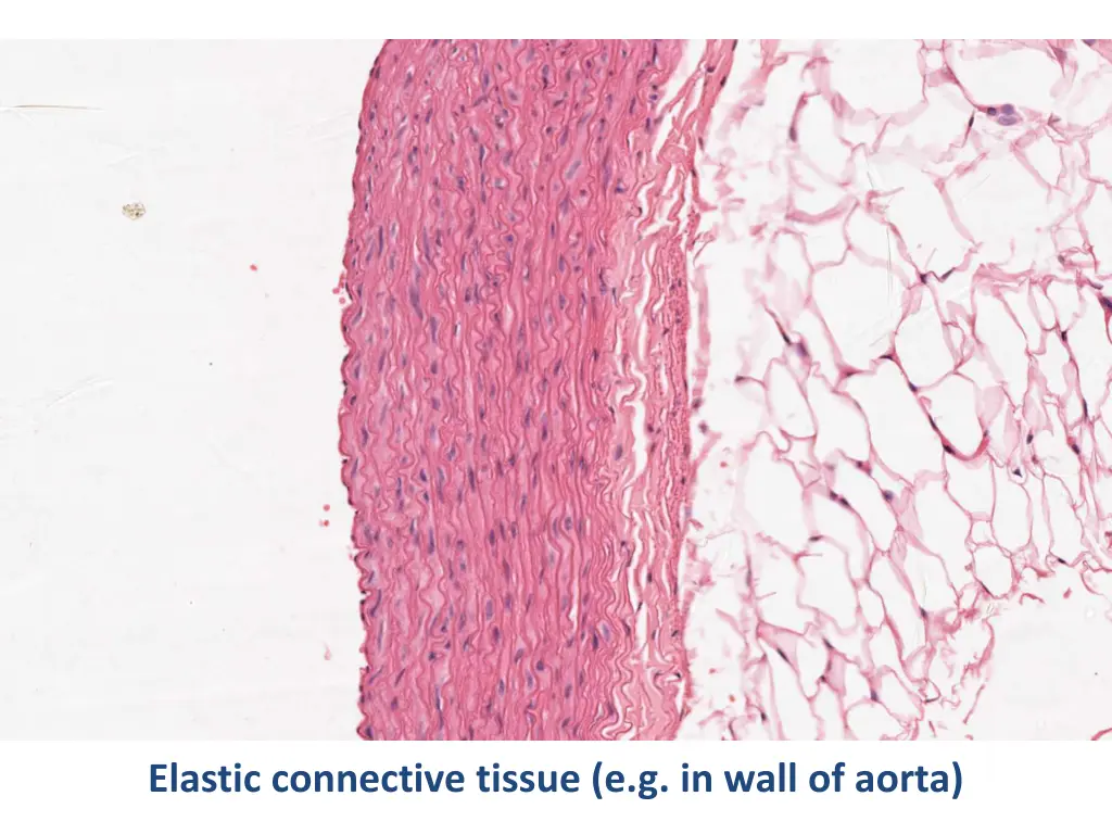 elastic connective tissue e g in wall of aorta 1