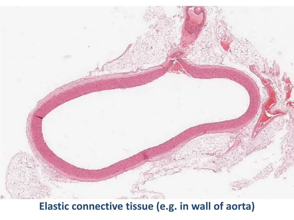 elastic connective tissue e g in wall of aorta