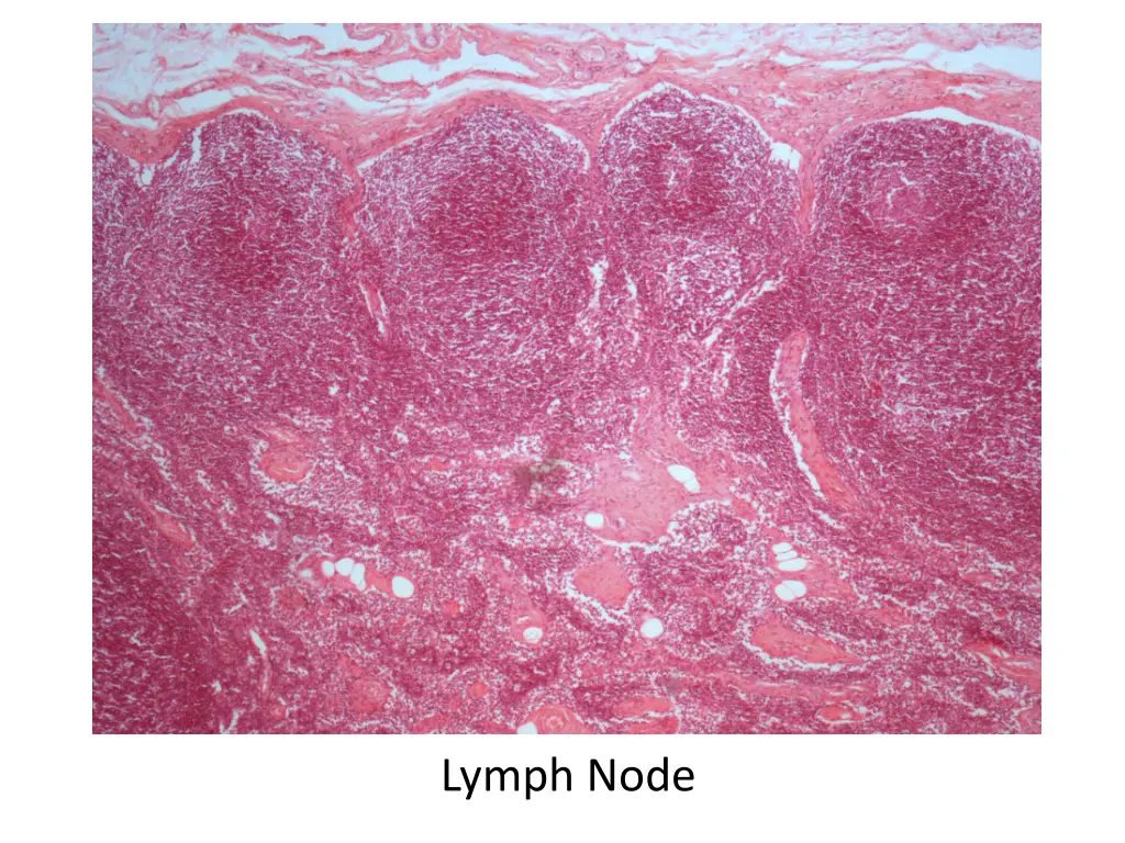 lymph node