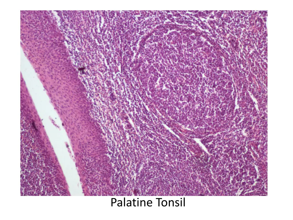 palatine tonsil