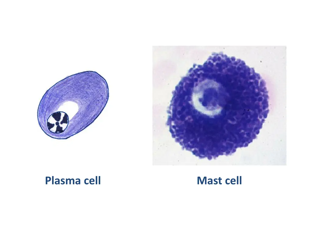 plasma cell