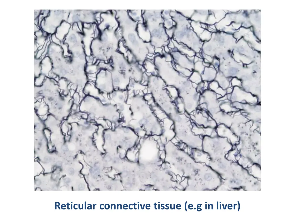 reticular connective tissue e g in liver 1