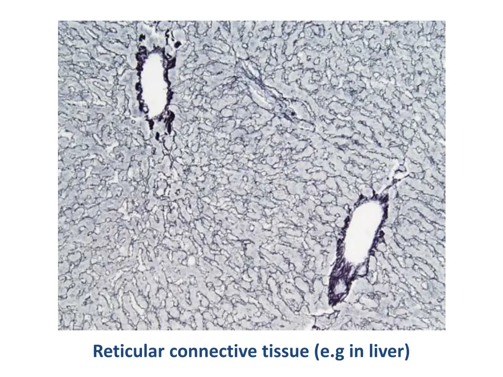 reticular connective tissue e g in liver