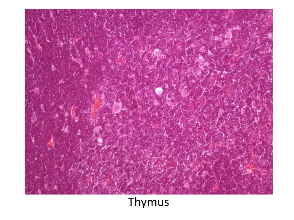 thymus 1