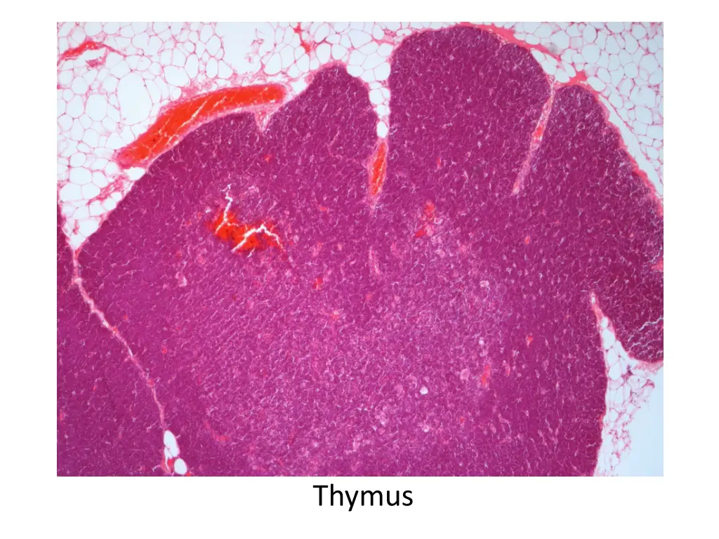 thymus