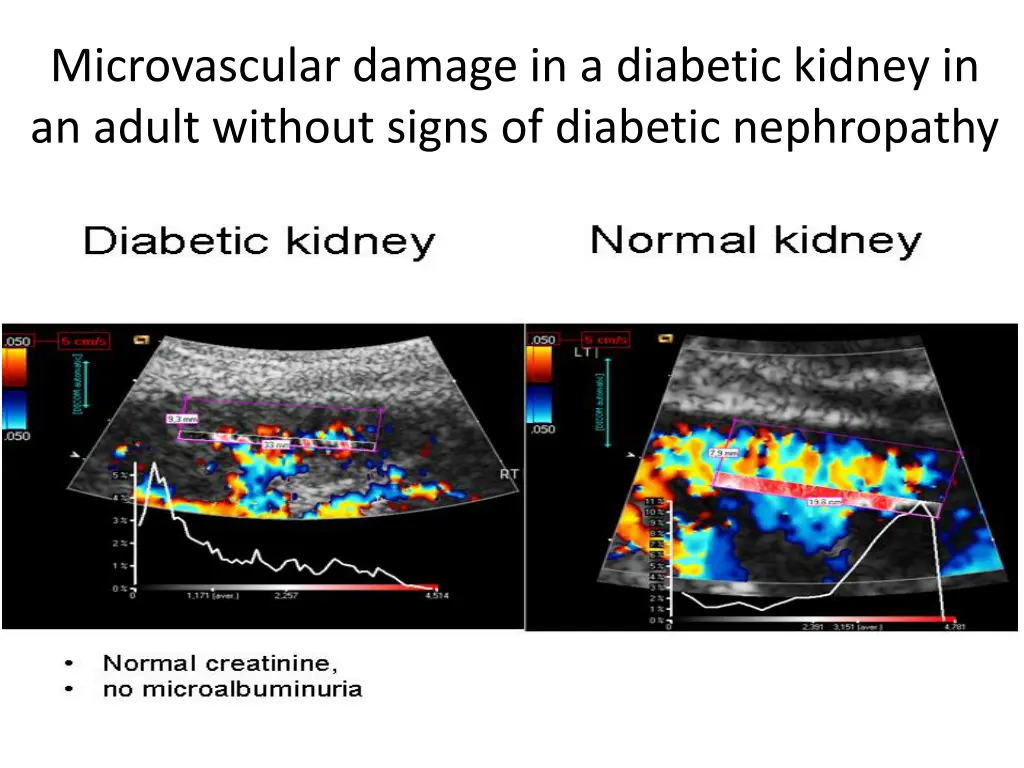 microvascular damage in a diabetic kidney