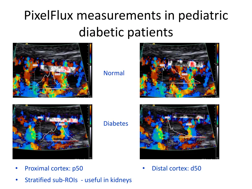 pixelflux measurements in pediatric diabetic