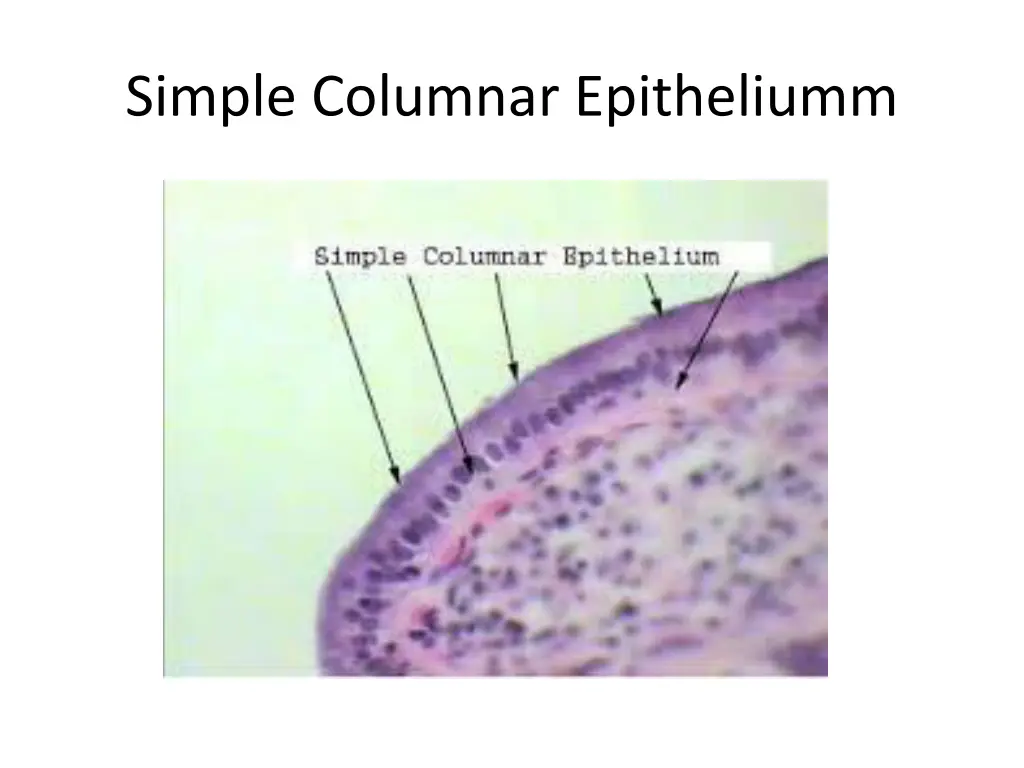 simple columnar epitheliumm