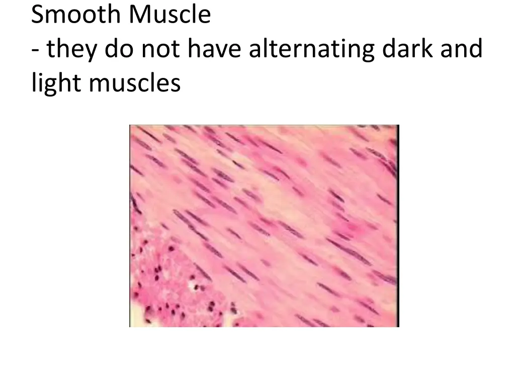 smooth muscle they do not have alternating dark