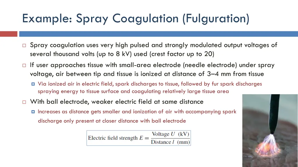 example spray coagulation fulguration