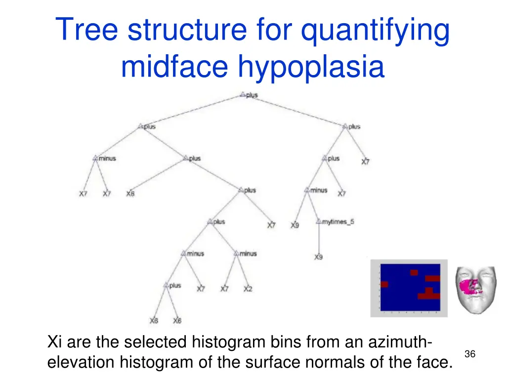 tree structure for quantifying midface hypoplasia