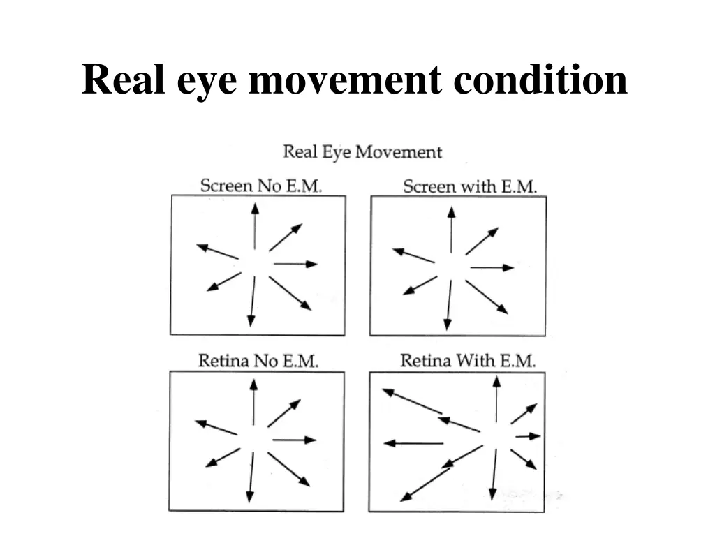 real eye movement condition