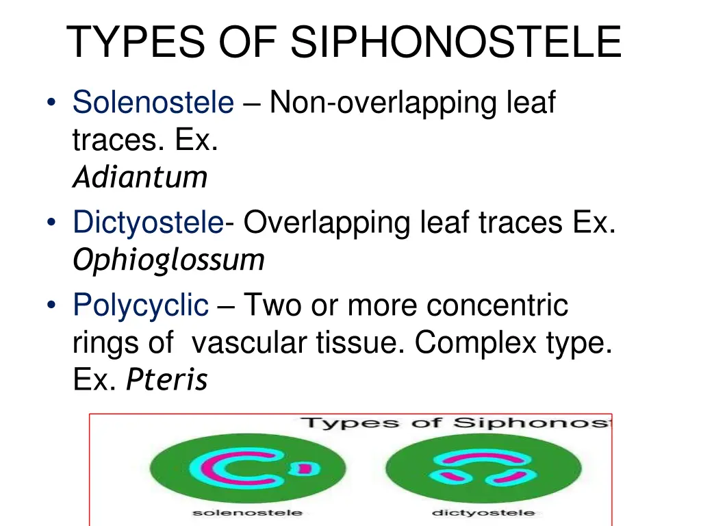 types of siphonostele