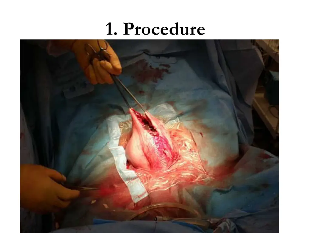 1 procedure 3