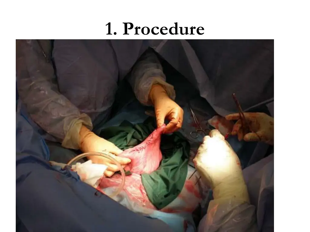 1 procedure 4