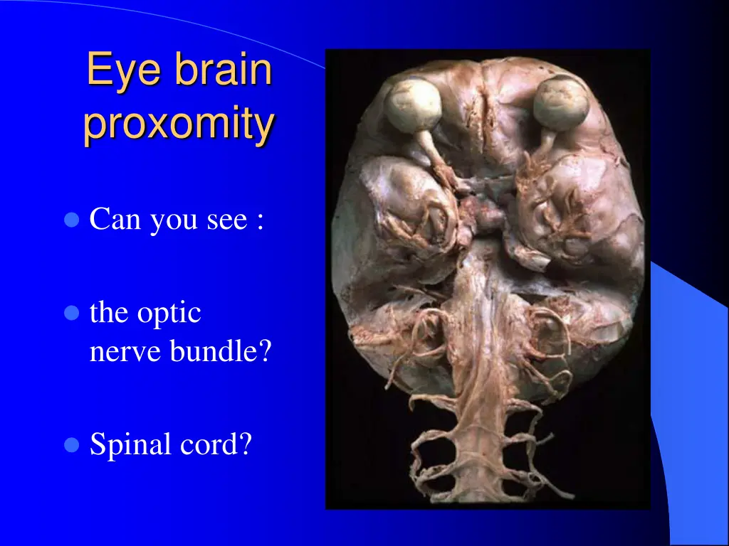 eye brain proxomity