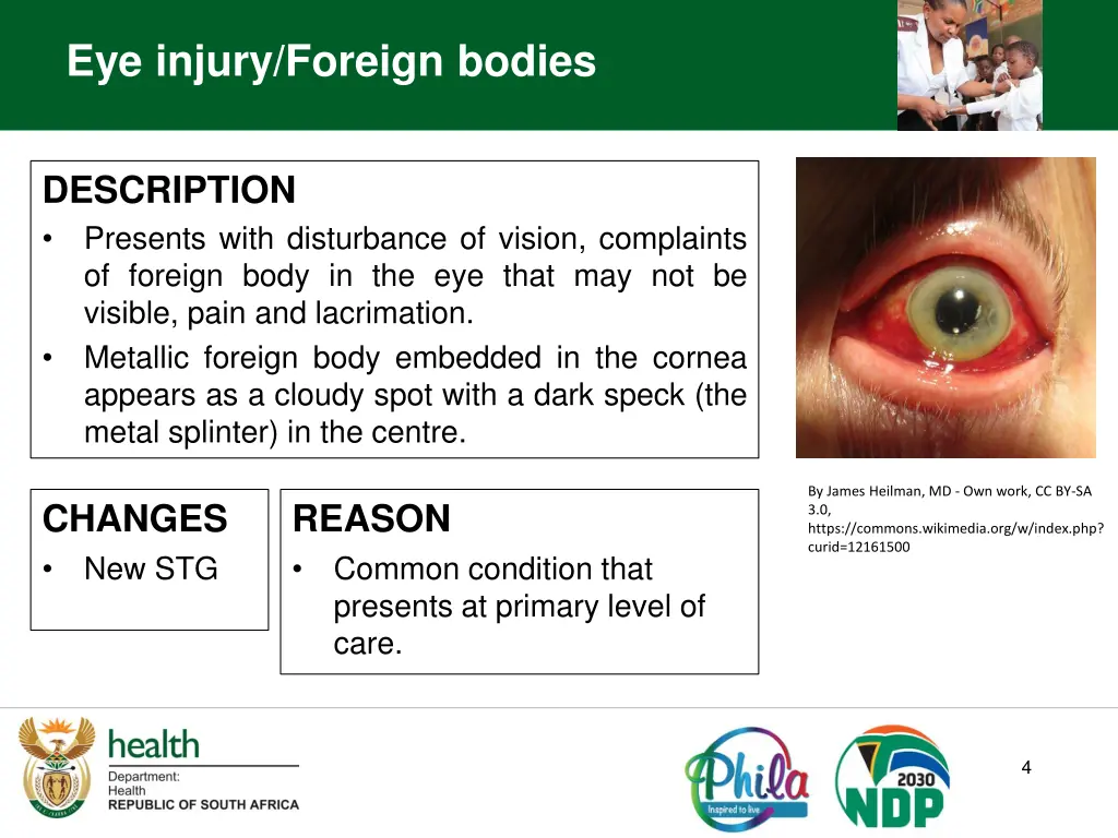 eye injury foreign bodies