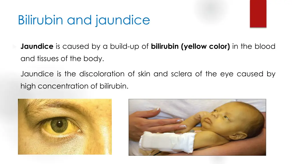 bilirubin and jaundice